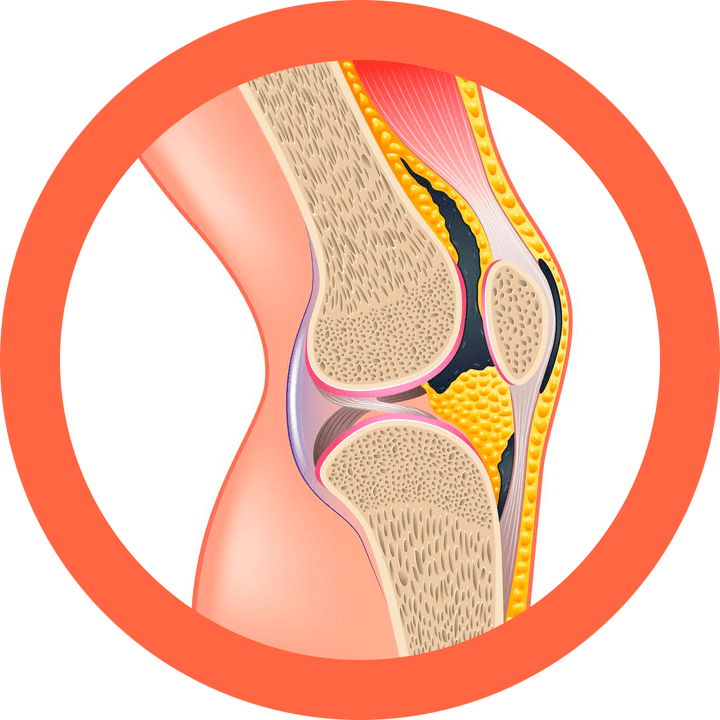 Hondroten - αποκαθιστά τις αρθρώσεις και τους μύες